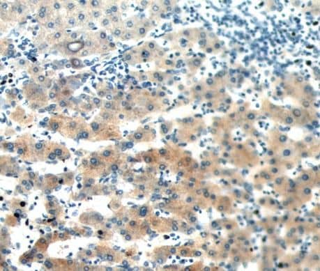 Immunohistochemistry SAA2 Antibody - BSA Free