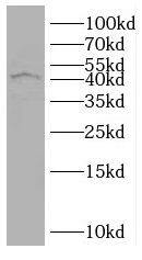 Western Blot: RUNDC3B Antibody - BSA Free [NBP3-45458] - MCF7 cells were subjected to SDS PAGE followed by western blot with (RUNDC3B antibody) at dilution of 1:500