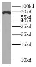 Western Blot: RUFY2 Antibody - BSA Free [NBP3-45459] - PC-3 cells were subjected to SDS PAGE followed by western blot with (RUFY2 antibody) at dilution of 1:1500