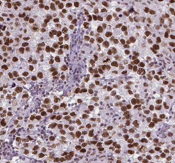 Immunohistochemistry: RUFY2 Antibody - BSA Free [NBP3-45459] - Immunohistochemistry of paraffin-embedded human testis using (RUFY2 antibody) at dilution of 1:100
