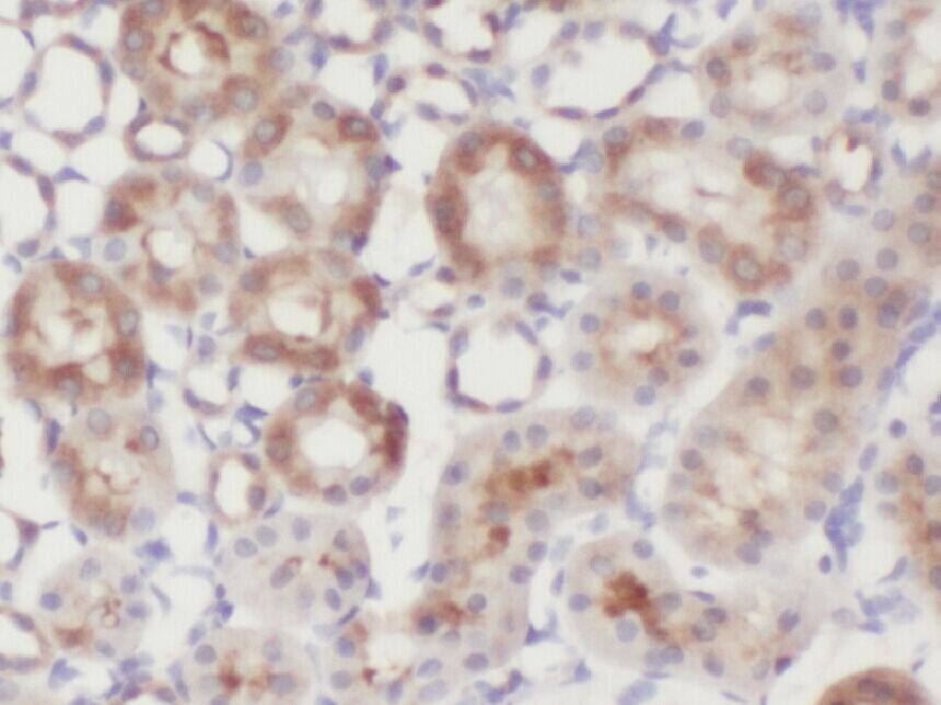 Immunohistochemistry ZNF497 Antibody - BSA Free