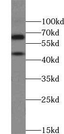 Western Blot ZNF497 Antibody - BSA Free
