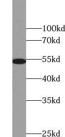 Western Blot: ZNF486 Antibody - BSA Free [NBP3-45462] - COLO 320 cells were subjected to SDS PAGE followed by western blot with (ZNF486 Antibody) at dilution of 1:500