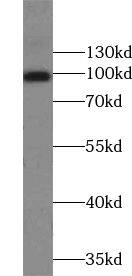 Western Blot: ZNF483 Antibody - BSA Free [NBP3-45463] - Fetal human brain tissue were subjected to SDS PAGE followed by western blot with (ZNF483 Antibody) at dilution of 1:300