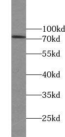 Western Blot ZNF443 Antibody - BSA Free