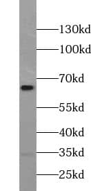 Western Blot: ZNF397 Antibody - BSA Free [NBP3-45468] - PC-3 cells were subjected to SDS PAGE followed by western blot with (ZNF397 Antibody) at dilution of 1:300