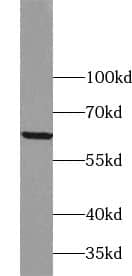 Western Blot: Zinc finger protein 395 Antibody - BSA Free [NBP3-45469] - Human brain tissue were subjected to SDS PAGE followed by western blot with (Zinc finger protein 395 antibody) at dilution of 1:400