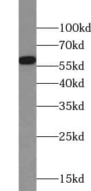 Western Blot: ZNF35 Antibody - BSA Free [NBP3-45472] - HeLa cells were subjected to SDS PAGE followed by western blot with (ZNF35 antibody) at dilution of 1:300