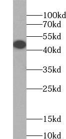Western Blot: ZNF320 Antibody - BSA Free [NBP3-45475] - HEK-293 cells were subjected to SDS PAGE followed by western blot with (ZNF320 Antibody) at dilution of 1:300