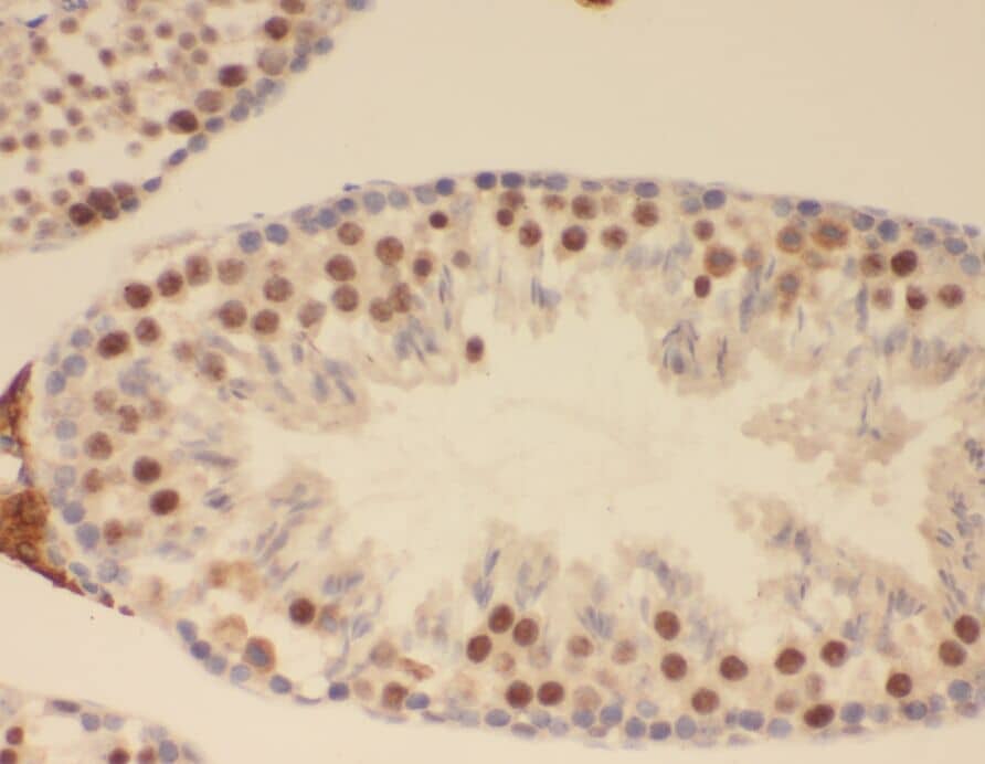 Immunohistochemistry: ZNF311 Antibody - BSA Free [NBP3-45476] - Immunohistochemistry of paraffin-embedded human testis slide using (ZNF311 Antibody) at dilution of 1:50