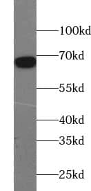 Western Blot: ZNF311 Antibody - BSA Free [NBP3-45476] - HL-60 cells were subjected to SDS PAGE followed by western blot with (ZNF311 antibody) at dilution of 1:4000