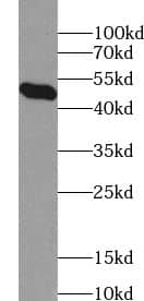 Western Blot: ZNF3 Antibody - BSA Free [NBP3-45477] - Mouse ovary tissue were subjected to SDS PAGE followed by western blot with (ZNF3 antibody) at dilution of 1:1000