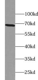 Western Blot: ZNF211 Antibody - BSA Free [NBP3-45484] - HeLa cells were subjected to SDS PAGE followed by western blot with (ZNF211 Antibody) at dilution of 1:600