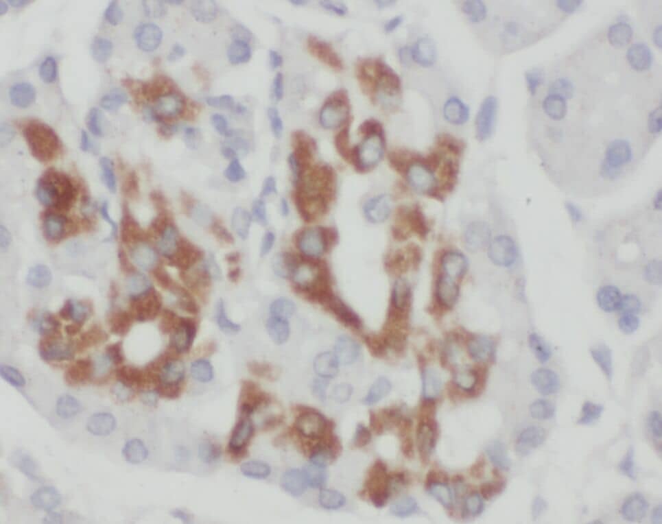 Immunohistochemistry ZNF2 Antibody - BSA Free