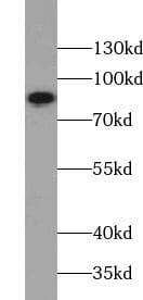 Western Blot ZNF184 Antibody - BSA Free
