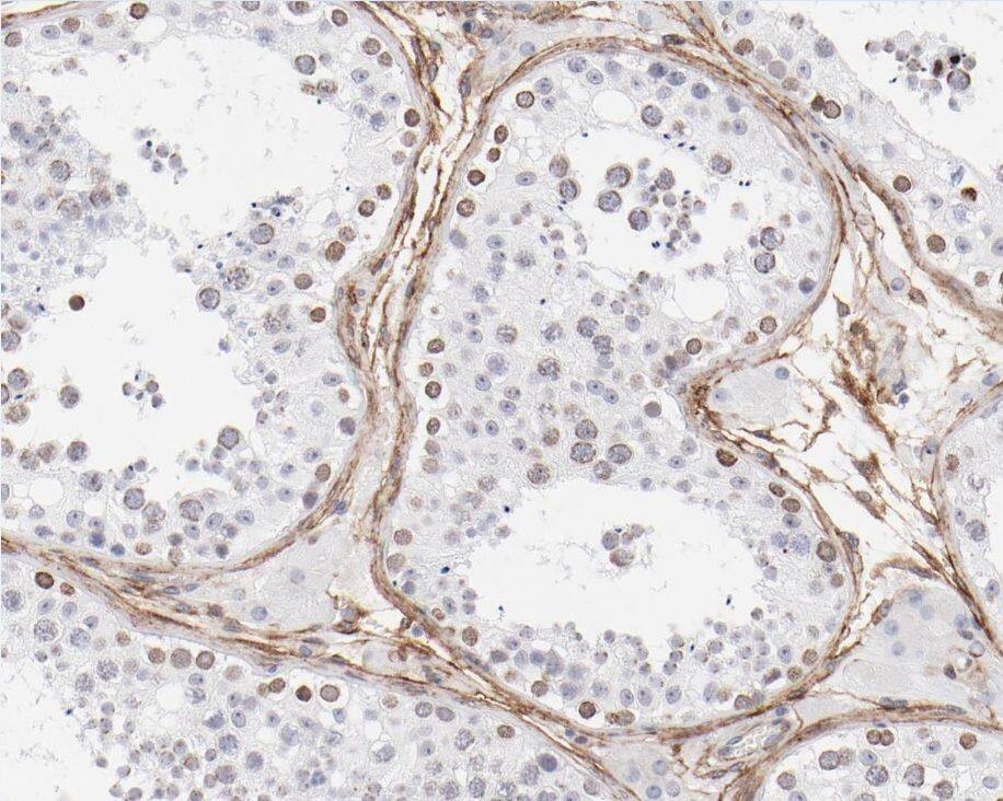 Immunohistochemistry ZNF174 Antibody - BSA Free