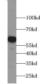 Western Blot: ZNF154 Antibody - BSA Free [NBP3-45488] - COS-7 cells were subjected to SDS PAGE followed by western blot with (ZNF154 Antibody) at dilution of 1:600