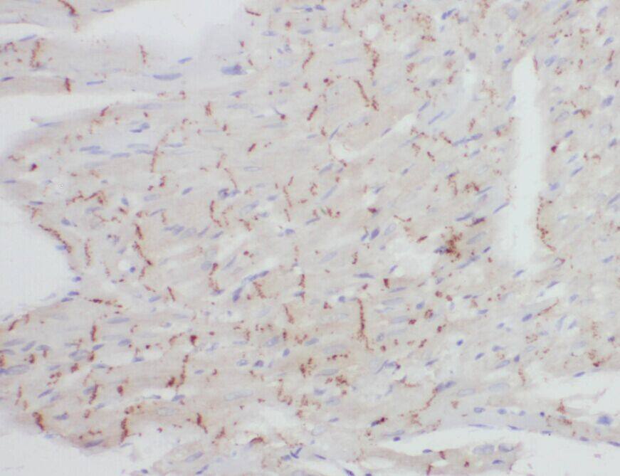 Immunohistochemistry: ZNF146 Antibody - BSA Free [NBP3-45489] - Immunohistochemistry of paraffin-embedded human heart using (ZNF146 antibody) at dilution of 1:100