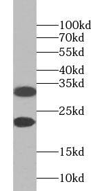 Western Blot: ZNF146 Antibody - BSA Free [NBP3-45489] - Mouse kidney tissue were subjected to SDS PAGE followed by western blot with (ZNF146 antibody) at dilution of 1:600