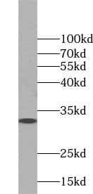 Western Blot: PAG608 Antibody - BSA Free [NBP3-45494] - Mouse testis tissue were subjected to SDS PAGE followed by western blot with (PAG608 antibody) at dilution of 1:800