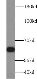 Western Blot: ZKSCAN1 Antibody - BSA Free [NBP3-45495] - HeLa cells were subjected to SDS PAGE followed by western blot with (ZKSCAN1 Antibody) at dilution of 1:600