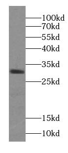 Western Blot: ZGLP1 Antibody - BSA Free [NBP3-45499] - Mouse ovary tissue were subjected to SDS PAGE followed by western blot with (ZZGLP1 Antibody) at dilution of 1:300