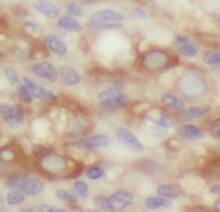 Immunohistochemistry: ZGLP1 Antibody - BSA Free [NBP3-45499] - Immunohistochemistry of paraffin-embedded human ovary using (ZGLP1 antibody) at dilution of 1:50