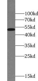 Western Blot: TIS11D Antibody - BSA Free [NBP3-45503] - HepG2 cells were subjected to SDS PAGE followed by western blot with (TIS11D antibody) at dilution of 1:500