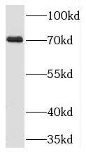 Western Blot: TIGD1 Antibody - BSA Free [NBP3-45504] - HepG2 cells were subjected to SDS PAGE followed by western blot with (TIGD1 antibody) at dilution of 1:400