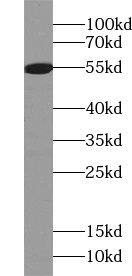 Western Blot ZFP2 Antibody - BSA Free