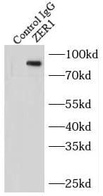Immunoprecipitation: ZER1 Antibody - BSA Free [NBP3-45506] - IP Result of anti-ZER1 (IP:, 3ug; Detection: 1:300) with mouse testis tissue lysate 4000ug.