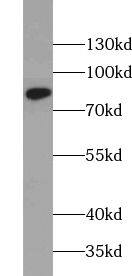Western Blot: ZER1 Antibody - BSA Free [NBP3-45506] - Mouse testis tissue were subjected to SDS PAGE followed by western blot with (ZER1 Antibody) at dilution of 1:300
