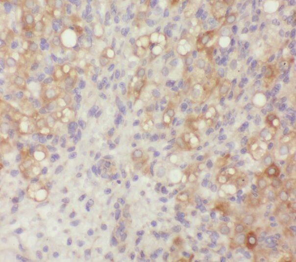 Immunohistochemistry ZER1 Antibody - BSA Free