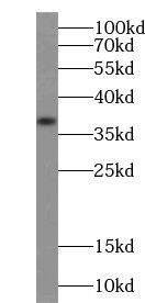 Western Blot: ZDHHC9 Antibody - BSA Free [NBP3-45507] - SH-SY5Y cells were subjected to SDS PAGE followed by western blot with (ZDHHC9 Antibody) at dilution of 1:300
