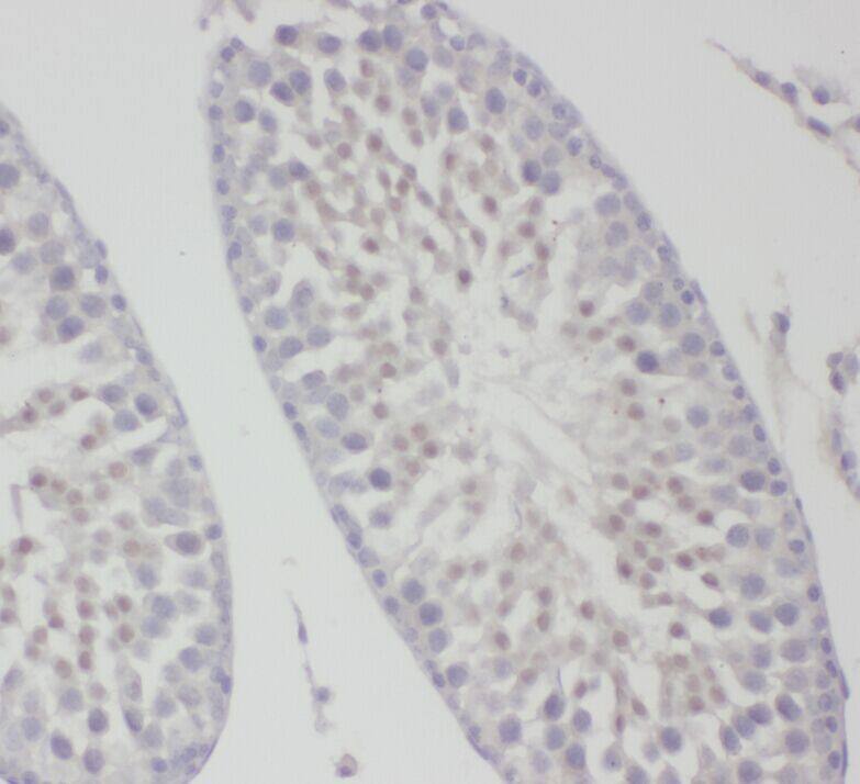 Immunohistochemistry ZDHHC9 Antibody - BSA Free