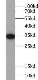 Western Blot: ZC3H8 Antibody - BSA Free [NBP3-45514] - K-562 cells were subjected to SDS PAGE followed by western blot with (ZC3H8 Antibody) at dilution of 1:2000