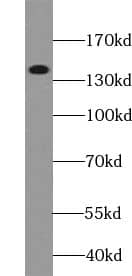 Western Blot: ZC3H4 Antibody - BSA Free [NBP3-45515] - Mouse brain tissue were subjected to SDS PAGE followed by western blot with (ZC3H4 antibody) at dilution of 1:500