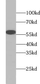 Western Blot: ZC3H12D Antibody - BSA Free [NBP3-45516] - Raji cells were subjected to SDS PAGE followed by western blot with (ZC3H12D Antibody) at dilution of 1:600