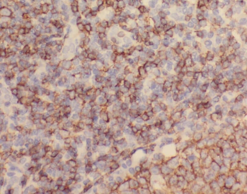 Immunohistochemistry: ZC3H12D Antibody - BSA Free [NBP3-45516] - Immunohistochemistry of paraffin-embedded human tonsillitis tissue slide using (ZC3H12D Antibody) at dilution of 1:50