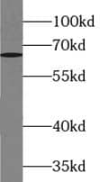 Western Blot: ZBTB46 Antibody - BSA Free [NBP3-45517] - RAW 264.7 cells were subjected to SDS PAGE followed by western blot with (ZBTB46 Antibody) at dilution of 1:600