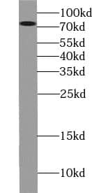 Western Blot: ZBTB20 Antibody - BSA Free [NBP3-45522] - L02 cells were subjected to SDS PAGE followed by western blot with (ZBTB20 antibody) at dilution of 1:1000