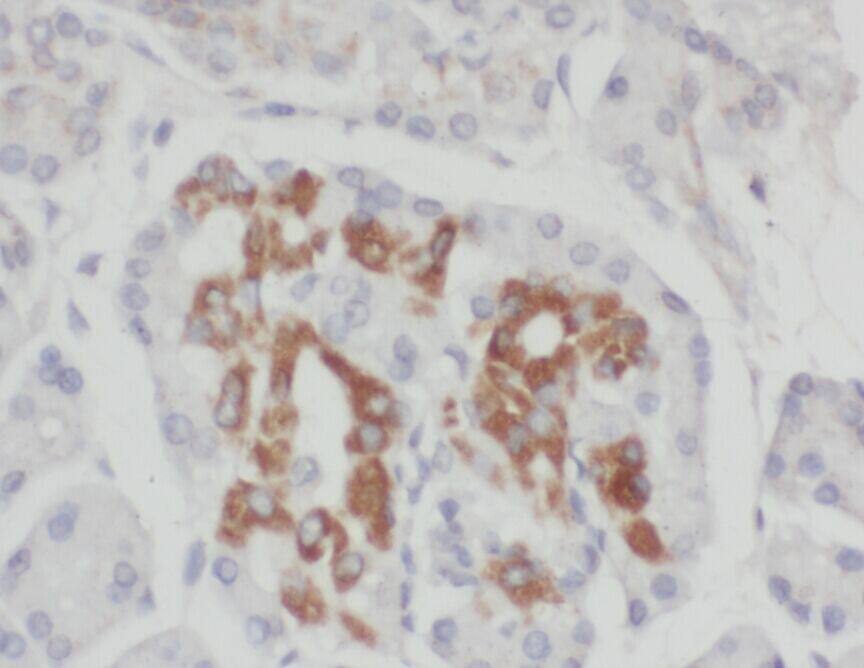 Immunohistochemistry ZADH2 Antibody - BSA Free