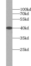 Western Blot: ZADH2 Antibody - BSA Free [NBP3-45525] - Mouse brain tissue were subjected to SDS PAGE followed by western blot with (ZADH2 antibody) at dilution of 1:1000