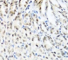 Immunohistochemistry: YTHDF3 Antibody - BSA Free [NBP3-45526] - Immunohistochemistry of paraffin-embedded mouse stomach using ( YTHDF3 Antibody) at dilution of 1:100