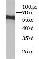 Western Blot YTHDF3 Antibody - BSA Free