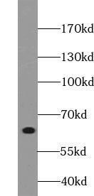 Western Blot: YTHDF2 Antibody - BSA Free [NBP3-45527] - Jurkat cells were subjected to SDS PAGE followed by western blot with (YTHDF2 Antibody) at dilution of 1:5000