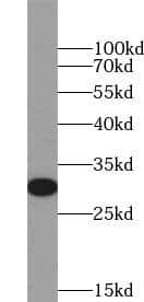 Western Blot YIPF5 Antibody - BSA Free