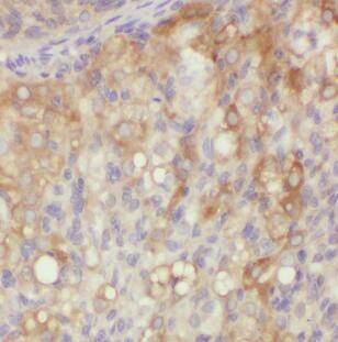 Immunohistochemistry XPO6 Antibody - BSA Free
