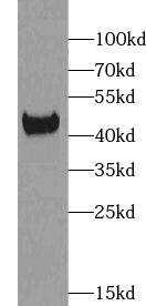 Western Blot: XKR6 Antibody - BSA Free [NBP3-45539] - Jurkat cells were subjected to SDS PAGE followed by western blot with (XKR6 Antibody) at dilution of 1:1000