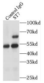 Immunoprecipitation Suppression of Tumorigenicity 7 Antibody - BSA Free